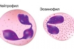 Biochemické a klinické krvné testy u psov